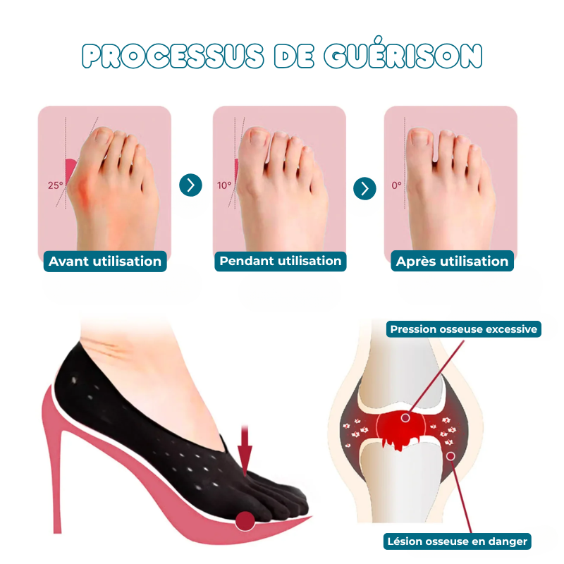 Chaussettes Orthopédiques - Soulage douleurs plantaires & Hallux Valgus