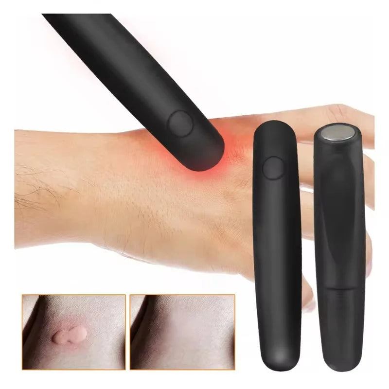 Stylo Infrarouge Anti-Démangeaison Piqûres de Moustiques