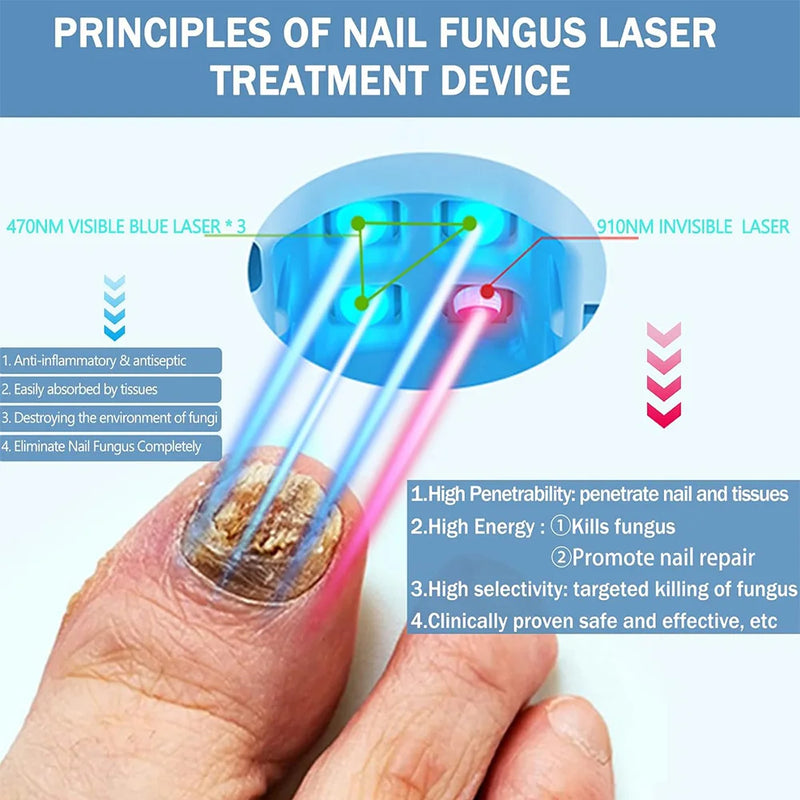 Appareil de traitement au laser pour champignon des ongles