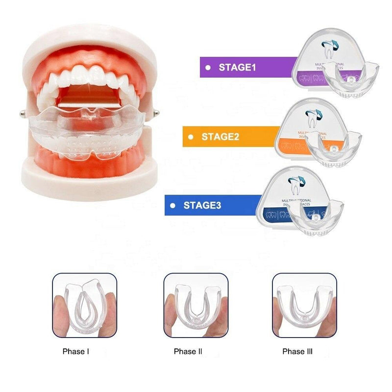 Pack de 3 Gouttières d'alignement dentaire