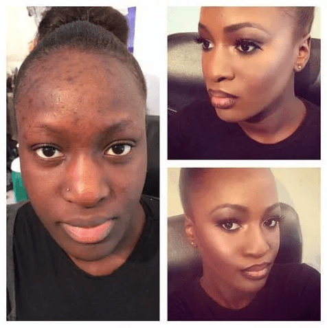 BB Crème couvrante - Teint miracle - DealValley