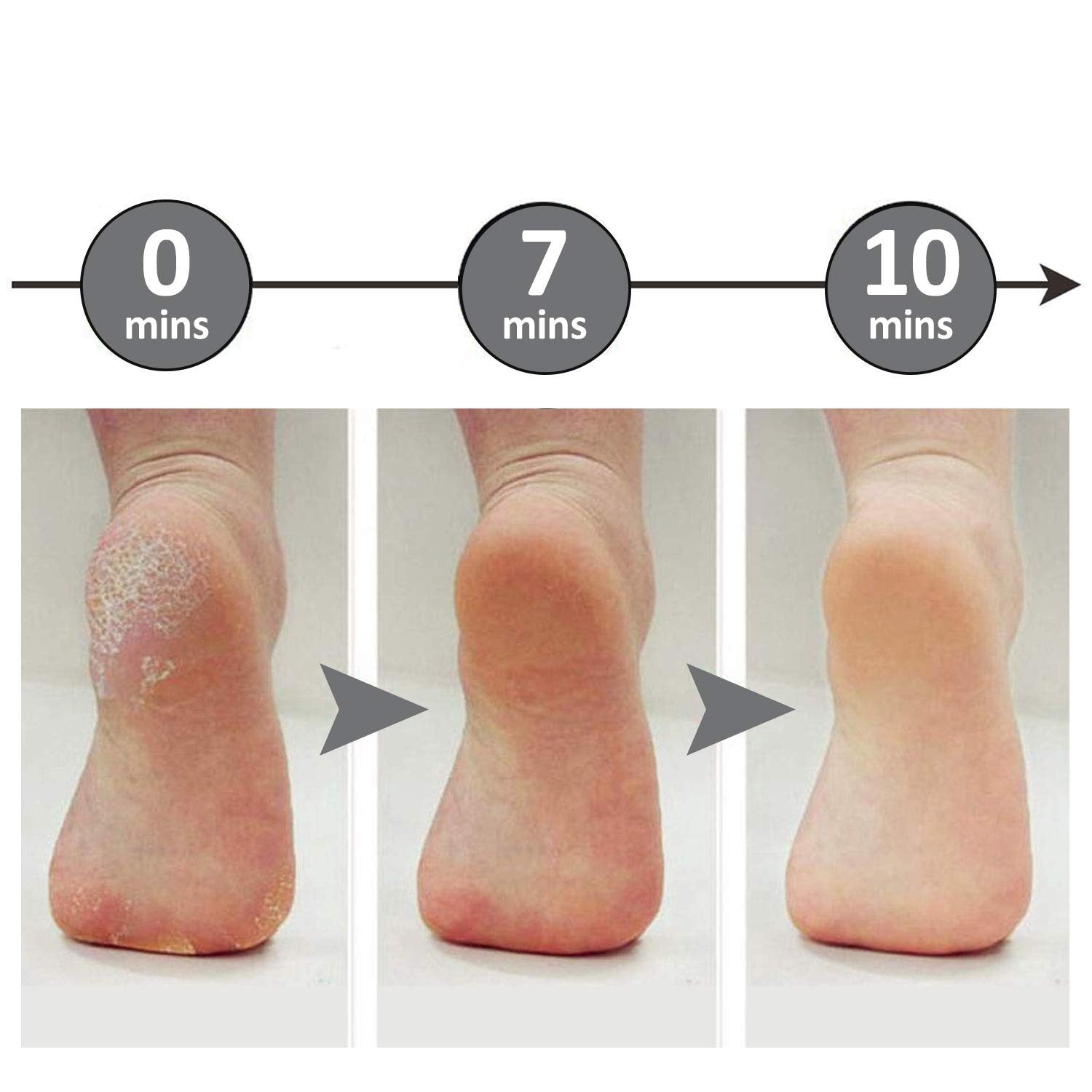 Lime électrique pour les pieds