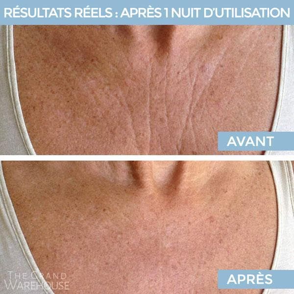 Lot de 2 Patchs anti-rides pour la poitrine