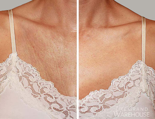 Lot de 2 Patchs anti-rides pour la poitrine