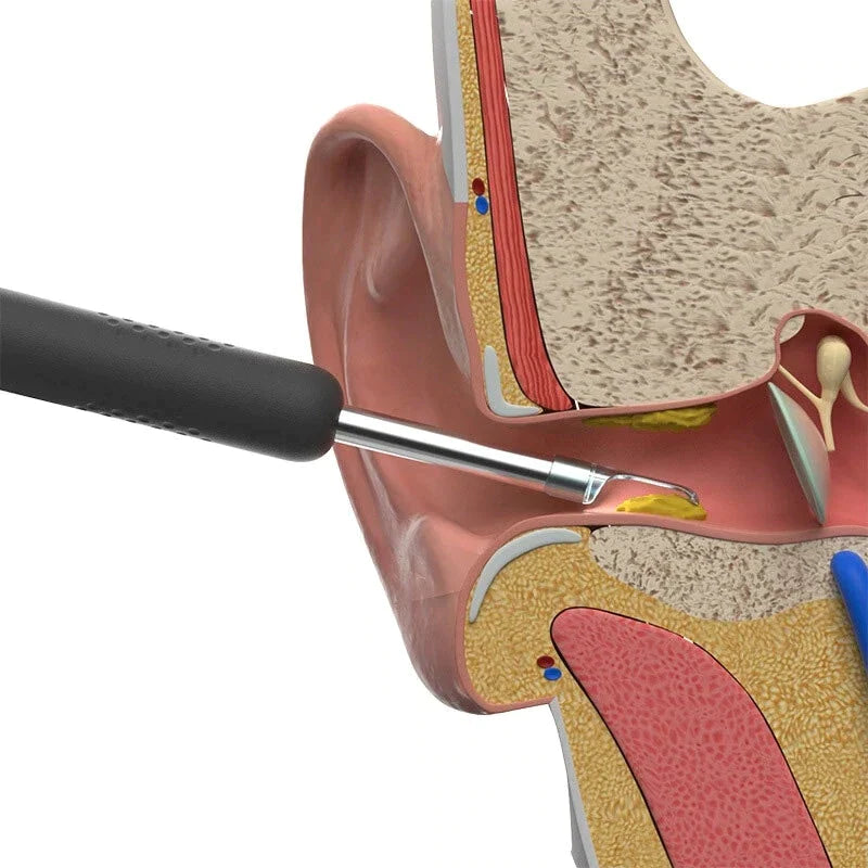 Nettoyeur d'oreilles souple avec caméra 